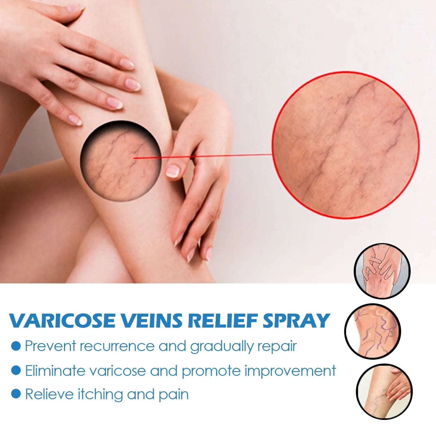 VARICOSE™ VEINS RELIEF