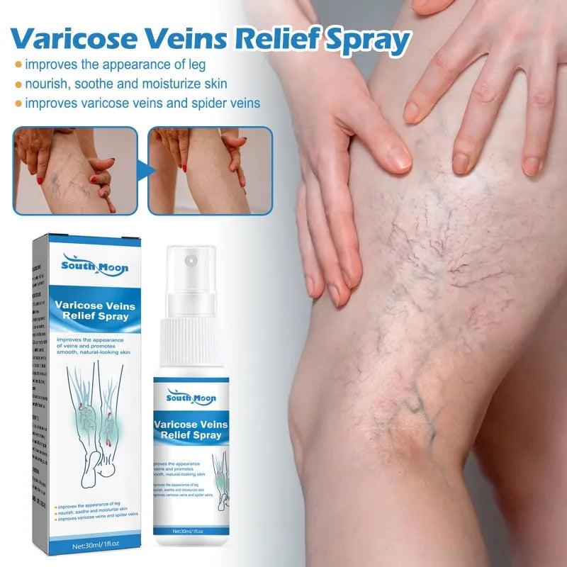 Spray for Varicose Veins