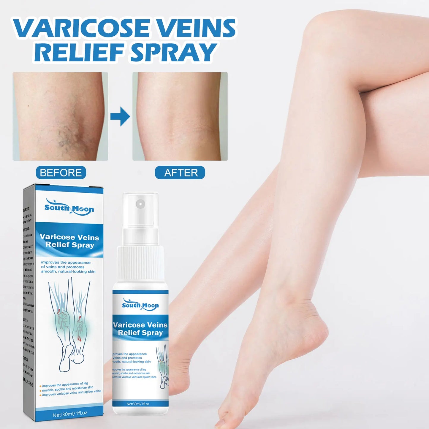 VARICOSE™ VEINS RELIEF