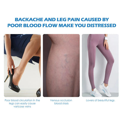 Spray for Varicose Veins