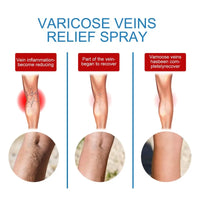 Spray for Varicose Veins
