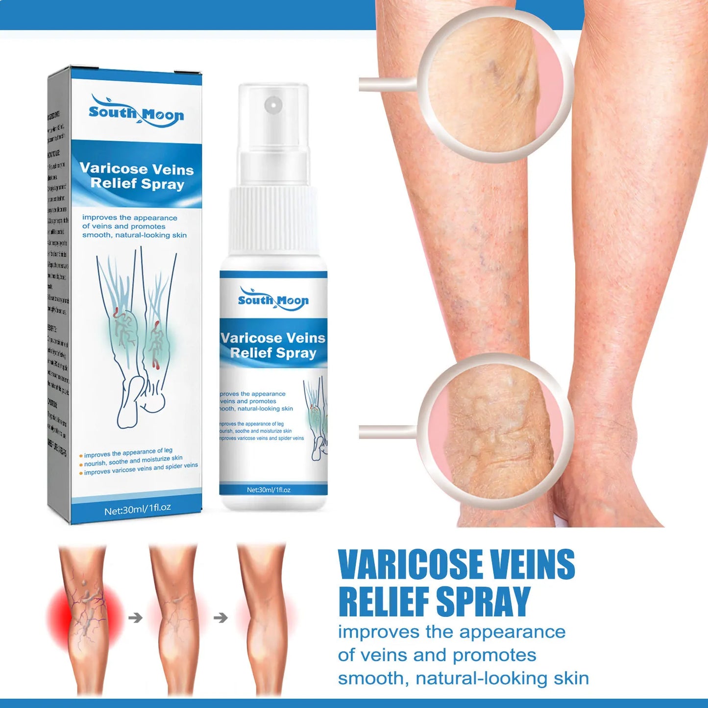 Spray for Varicose Veins