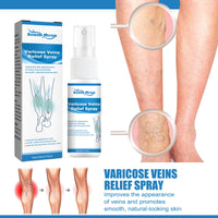Spray for Varicose Veins