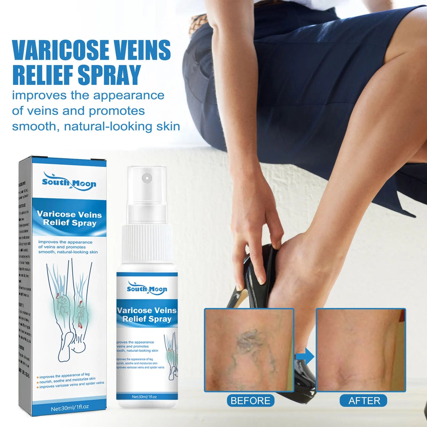VARICOSE™ VEINS RELIEF