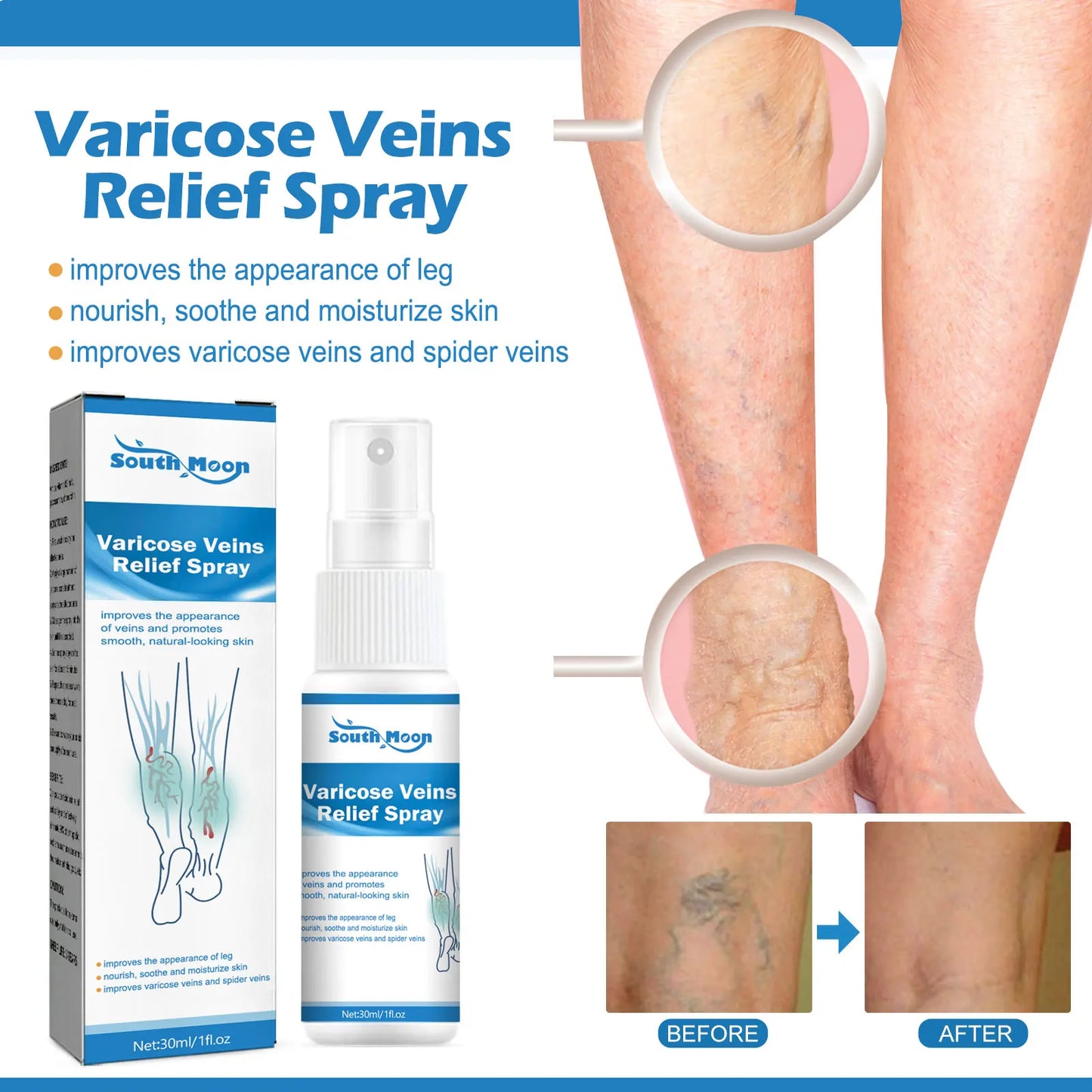 VARICOSE™ VEINS RELIEF