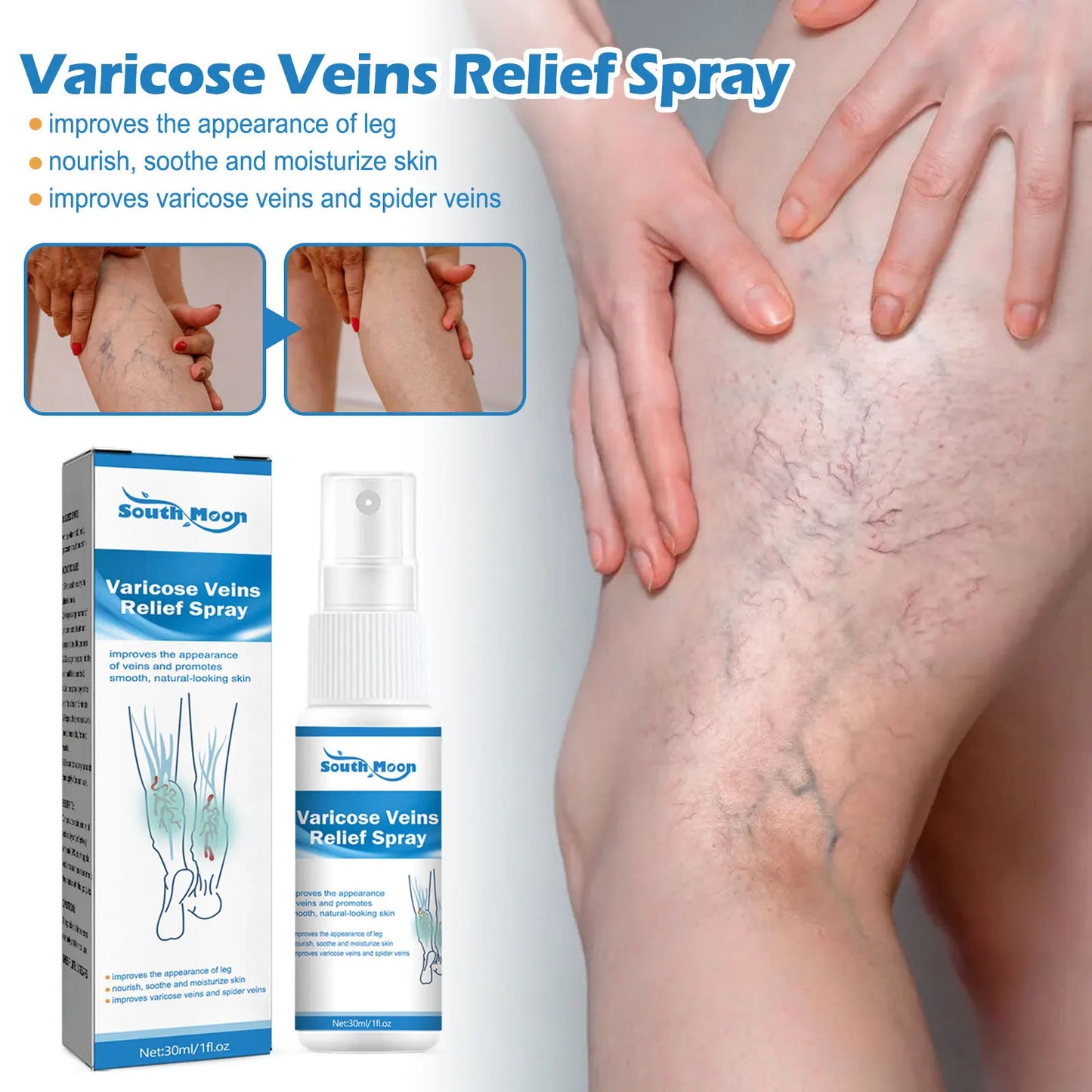 Spray for Varicose Veins
