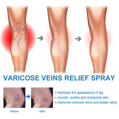 VARICOSE™ VEINS RELIEF